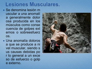 Lesiones Musculares.Se denomina lesión muscular a una anomalía generalmente dolorosa producida en los músculos como consecuencia de golpes externos o sobreesfuerzos.Una anomalía dolorosa que se produce a nivel muscular, siendo sus causas debidas por lo general a un exceso de esfuerzo o golpe externo.