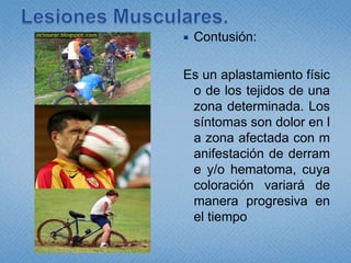 Lesiones Musculares.Contusión:Es un aplastamiento físico de los tejidos de una zona determinada. Los síntomas son dolor en la zona afectada con manifestación de derrame y/o hematoma, cuya coloración variará de manera progresiva en el tiempo