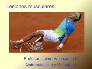 Lesiones musculares.
Profesor; Jaime Valenzuela C.
Quiromasajista y Osteopata.
 