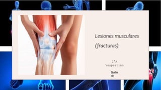 Lesiones musculares
(fracturas)
2°A
Vespertino
Galin
do
 