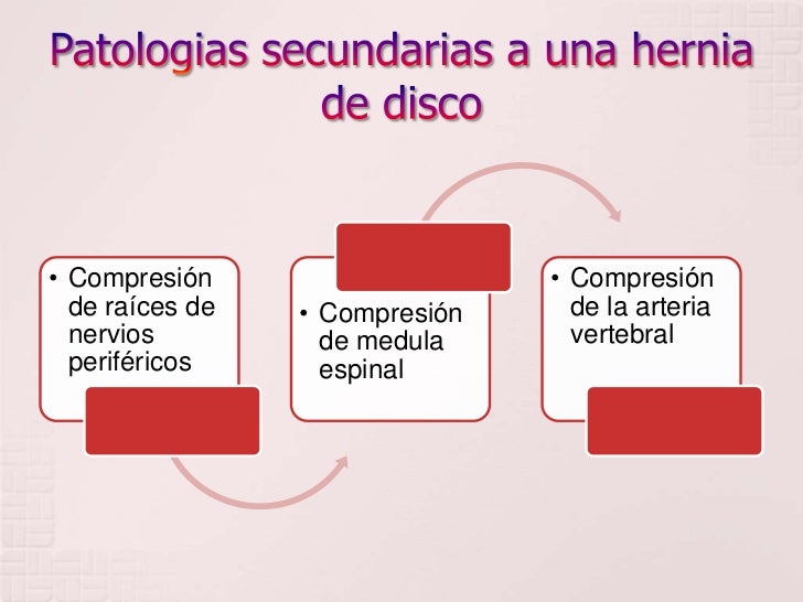 Las vértebras cervicales el desplazamiento y el tratamiento
