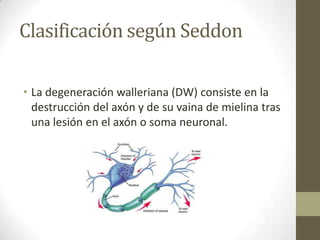 Clasificación según Seddon

• La degeneración walleriana (DW) consiste en la
  destrucción del axón y de su vaina de mielina tras
  una lesión en el axón o soma neuronal.
 