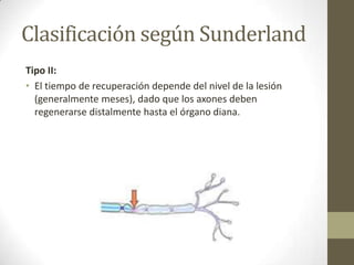 Clasificación según Sunderland
Tipo II:
• El tiempo de recuperación depende del nivel de la lesión
  (generalmente meses), dado que los axones deben
  regenerarse distalmente hasta el órgano diana.
 
