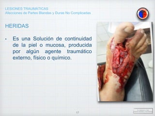 LESIONES TRAUMÁTICAS
Afecciones de Partes Blandas y Duras No Complicadas
HERIDAS
• Es una Solución de continuidad
de la piel o mucosa, producida
por algún agente traumático
externo, físico o químico.
Dr. Vejarano A., Willy
Docente Ortopedia y Traumatología
17
 