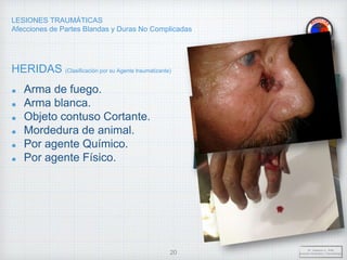 LESIONES TRAUMÁTICAS
Afecciones de Partes Blandas y Duras No Complicadas
HERIDAS (Clasificación por su Agente traumatizante)
Arma de fuego.
Arma blanca.
Objeto contuso Cortante.
Mordedura de animal.
Por agente Químico.
Por agente Físico.
Dr. Vejarano A., Willy
Docente Ortopedia y Traumatología
20
 