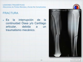 LESIONES TRAUMÁTICAS
Afecciones de Partes Blandas y Duras No Complicadas
FRACTURA
Es la interrupción de la
continuidad Ósea y/o Cartílago
articular, debida a un
traumatismo mecánico.
Dr. Vejarano A., Willy
Docente Ortopedia y Traumatología
23
 