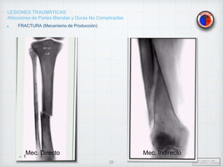 LESIONES TRAUMÁTICAS
Afecciones de Partes Blandas y Duras No Complicadas
Dr. Vejarano A., Willy
Docente Ortopedia y Traumatología
25
Mec. Directo Mec. Indirecto
FRACTURA (Mecanismo de Producción)
 