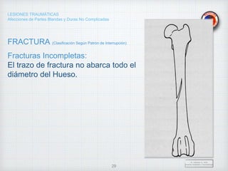 LESIONES TRAUMÁTICAS
Afecciones de Partes Blandas y Duras No Complicadas
FRACTURA (Clasificación Según Patrón de Interrupción)
Fracturas Incompletas:
El trazo de fractura no abarca todo el
diámetro del Hueso.
Dr. Vejarano A., Willy
Docente Ortopedia y Traumatología
29
 