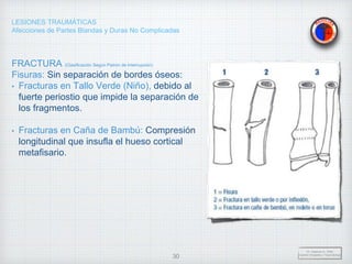 LESIONES TRAUMÁTICAS
Afecciones de Partes Blandas y Duras No Complicadas
FRACTURA (Clasificación Según Patrón de Interrupción)
Fisuras: Sin separación de bordes óseos:
• Fracturas en Tallo Verde (Niño), debido al
fuerte periostio que impide la separación de
los fragmentos.
• Fracturas en Caña de Bambú: Compresión
longitudinal que insufla el hueso cortical
metafisario.
Dr. Vejarano A., Willy
Docente Ortopedia y Traumatología
30
 