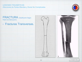 LESIONES TRAUMÁTICAS
Afecciones de Partes Blandas y Duras No Complicadas
FRACTURA (Clasificación Según
Patrón de Interrupción).
• Fracturas Transversas.
Dr. Vejarano A., Willy
Docente Ortopedia y Traumatología
32
 