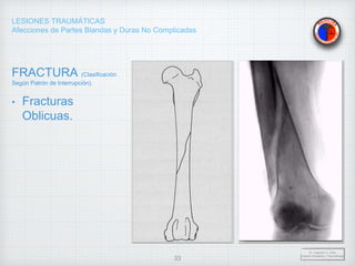 LESIONES TRAUMÁTICAS
Afecciones de Partes Blandas y Duras No Complicadas
FRACTURA (Clasificación
Según Patrón de Interrupción).
• Fracturas
Oblicuas.
Dr. Vejarano A., Willy
Docente Ortopedia y Traumatología
33
 