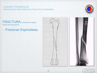 LESIONES TRAUMÁTICAS
Afecciones de Partes Blandas y Duras No Complicadas
FRACTURA (Clasificación Según
Patrón de Interrupción).
• Fracturas Espiroideas.
Dr. Vejarano A., Willy
Docente Ortopedia y Traumatología
34
 