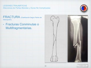 LESIONES TRAUMÁTICAS
Afecciones de Partes Blandas y Duras No Complicadas
FRACTURA (Clasificación Según Patrón de
Interrupción).
• Fracturas Conminutas o
Multifragmentarias.
Dr. Vejarano A., Willy
Docente Ortopedia y Traumatología
35
 