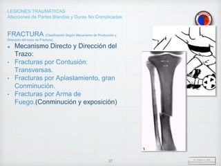 LESIONES TRAUMÁTICAS
Afecciones de Partes Blandas y Duras No Complicadas
FRACTURA (Clasificación Según Mecanismo de Producción y
Dirección del trazo de Fractura).
Mecanismo Directo y Dirección del
Trazo:
• Fracturas por Contusión:
Transversas.
• Fracturas por Aplastamiento, gran
Conminución.
• Fracturas por Arma de
Fuego.(Conminución y exposición)
Dr. Vejarano A., Willy
Docente Ortopedia y Traumatología
37
 