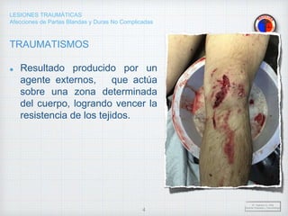LESIONES TRAUMÁTICAS
Afecciones de Partes Blandas y Duras No Complicadas
TRAUMATISMOS
Resultado producido por un
agente externos, que actúa
sobre una zona determinada
del cuerpo, logrando vencer la
resistencia de los tejidos.
Dr. Vejarano A., Willy
Docente Ortopedia y Traumatología
4
 