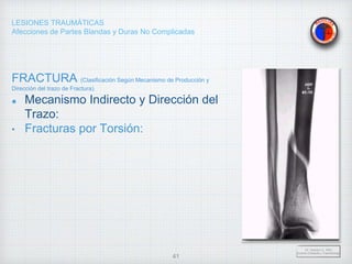 LESIONES TRAUMÁTICAS
Afecciones de Partes Blandas y Duras No Complicadas
FRACTURA (Clasificación Según Mecanismo de Producción y
Dirección del trazo de Fractura).
Mecanismo Indirecto y Dirección del
Trazo:
• Fracturas por Torsión:
Dr. Vejarano A., Willy
Docente Ortopedia y Traumatología
41
 