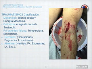 LESIONES TRAUMÁTICAS
Afecciones de Partes Blandas y Duras No Complicadas
TRAUMATISMOS Clasificación:
• Mecánicos: agente causal=
Energía Mecánica.
• Químicos: el agente causal=
Sustancia.
• Por agentes físicos: Temperatura,
Electricidad.
Cerrados: (Contusiones,
Esguinces, Luxaciones).
Abiertos: (Heridas, Fx. Expuestas,
Lx. Exp.).
Dr. Vejarano A., Willy
Docente Ortopedia y Traumatología
5
 