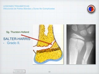 LESIONES TRAUMÁTICAS
Afecciones de Partes Blandas y Duras No Complicadas
SALTER-HARRIS
• Grado II.
Dr. Vejarano A., Willy
Docente Ortopedia y Traumatología 50
Sg. Thurston-Holland
 