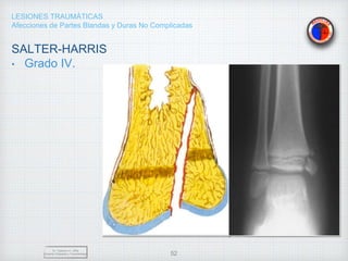 LESIONES TRAUMÁTICAS
Afecciones de Partes Blandas y Duras No Complicadas
SALTER-HARRIS
• Grado IV.
Dr. Vejarano A., Willy
Docente Ortopedia y Traumatología 52
 