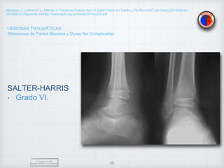 LESIONES TRAUMÁTICAS
Afecciones de Partes Blandas y Duras No Complicadas
SALTER-HARRIS
• Grado VI.
Dr. Vejarano A., Willy
Docente Ortopedia y Traumatología 55
Masguijo J, Lanfranchi L, Allende V. Fracturas Fisarias tipo VI Salter Harris en Tobillo y Pie.RevAAOT.(en linea).2014(Marzo-
2019)Nro2.Disponible en:http://www.aaot.org.ar/revista/2015/n2/5.pdf
 
