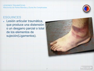 LESIONES TRAUMÁTICAS
Afecciones de Partes Blandas y Duras No Complicadas
ESGUINCES
Lesión articular traumática,
que produce una distensión
o un desgarro parcial o total
de los elementos de
sujeción(Ligamentos).
Dr. Vejarano A., Willy
Docente Ortopedia y Traumatología
7
 