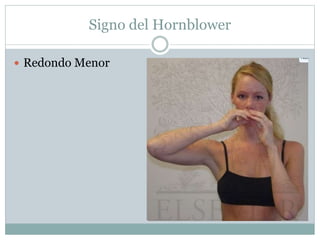 Signo del Hornblower
 Redondo Menor
 