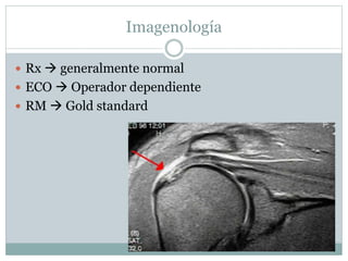 Imagenología
 Rx  generalmente normal
 ECO  Operador dependiente
 RM  Gold standard
 