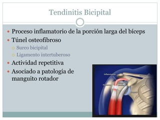 Tendinitis Bicipital
 Proceso inflamatorio de la porción larga del bíceps
 Túnel osteofibroso
 Surco bicipital
 Ligamento intertuberoso
 Actividad repetitiva
 Asociado a patología de
manguito rotador
 