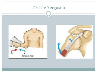 Test de Yergason
 