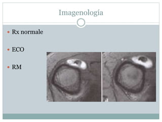 Imagenología
 Rx normale
 ECO
 RM
 