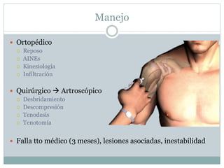 Manejo
 Ortopédico
 Reposo
 AINEs
 Kinesiología
 Infiltración
 Quirúrgico  Artroscópico
 Desbridamiento
 Descompresión
 Tenodesis
 Tenotomía
 Falla tto médico (3 meses), lesiones asociadas, inestabilidad
 