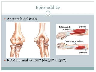 Epicondilitis
 Anatomía del codo
 ROM normal  100º (de 30º a 130º)
 