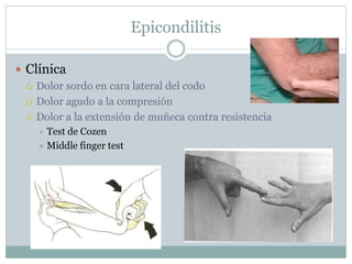 Epicondilitis
 Clínica
 Dolor sordo en cara lateral del codo
 Dolor agudo a la compresión
 Dolor a la extensión de muñeca contra resistencia
 Test de Cozen
 Middle finger test
 
