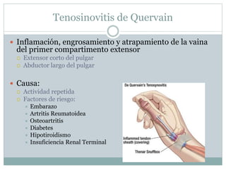 Tenosinovitis de Quervain
 Inflamación, engrosamiento y atrapamiento de la vaina
del primer compartimento extensor
 Extensor corto del pulgar
 Abductor largo del pulgar
 Causa:
 Actividad repetida
 Factores de riesgo:
 Embarazo
 Artritis Reumatoidea
 Osteoartritis
 Diabetes
 Hipotiroidismo
 Insuficiencia Renal Terminal
 