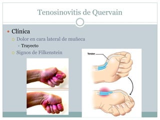 Tenosinovitis de Quervain
 Clínica
 Dolor en cara lateral de muñeca
 Trayecto
 Signos de Filkenstein
 
