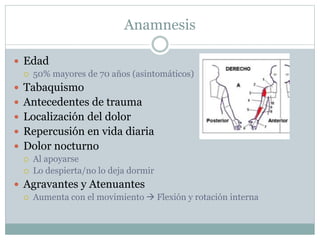Anamnesis
 Edad
 50% mayores de 70 años (asintomáticos)
 Tabaquismo
 Antecedentes de trauma
 Localización del dolor
 Repercusión en vida diaria
 Dolor nocturno
 Al apoyarse
 Lo despierta/no lo deja dormir
 Agravantes y Atenuantes
 Aumenta con el movimiento  Flexión y rotación interna
 