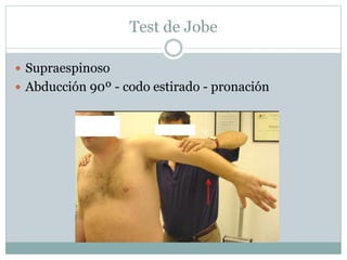 Test de Jobe
 Supraespinoso
 Abducción 90º - codo estirado - pronación
 