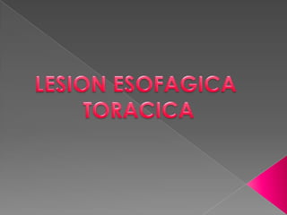LESION ESOFAGICA TORACICA 