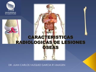 DR. JUAN CARLOS VAZQUEZ GARCIA R1-IMAGEN
 