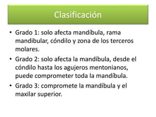 Clasificación
• Grado 1: solo afecta mandíbula, rama
mandibular, cóndilo y zona de los terceros
molares.
• Grado 2: solo afecta la mandíbula, desde el
cóndilo hasta los agujeros mentonianos,
puede comprometer toda la mandíbula.
• Grado 3: compromete la mandíbula y el
maxilar superior.

 