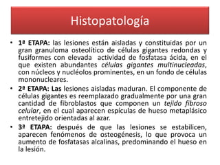 Histopatología
• 1ª ETAPA: las lesiones están aisladas y constituidas por un
gran granuloma osteolítico de células gigantes redondas y
fusiformes con elevada actividad de fosfatasa ácida, en el
que existen abundantes células gigantes multinucleadas,
con núcleos y nucléolos prominentes, en un fondo de células
mononucleares.
• 2ª ETAPA: Las lesiones aisladas maduran. El componente de
células gigantes es reemplazado gradualmente por una gran
cantidad de fibroblastos que componen un tejido fibroso
celular, en el cual aparecen espículas de hueso metaplásico
entretejido orientadas al azar.
• 3ª ETAPA: después de que las lesiones se estabilicen,
aparecen fenómenos de osteogénesis, lo que provoca un
aumento de fosfatasas alcalinas, predominando el hueso en
la lesión.

 