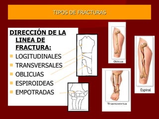 TIPOS DE FRACTURAS DIRECCIÓN DE LA LINEA DE FRACTURA: LOGITUDINALES TRANSVERSALES OBLICUAS ESPIROIDEAS EMPOTRADAS 