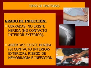 TIPOS DE FRACTURAS GRADO DE INFECCIÓN: CERRADAS: NO EXISTE HERIDA (NO CONTACTO INTERIOR-EXTERIOR). ABIERTAS: EXISTE HERIDA (SI CONTACTO INTERIOR-EXTERIOR), RIESGO DE HEMORRAGIA E INFECCIÓN. 