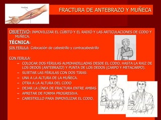 FRACTURA DE ANTEBRAZO Y MUÑECA OBJETIVO :  INMOVILIZAR EL CÚBITO Y EL RADIÓ Y LAS ARTICULACIONES DE CODO Y MUÑECA. TÉCNICA : SIN FERULA : Colocación de cabestrillo y contracabestrillo CON FERULA : COLOCAR DOS FÉRULAS ALMOHADILLADAS DESDE EL CODO, HASTA LA RAIZ DE LOS DEDOS (ANTEBRAZO) Y PUNTA DE LOS DEDOS (CARPO Y METACARPO). SUJETAR LAS FÉRULAS CON DOS TIRAS: UNA A LA ALTURA DE LA MUÑECA. OTRA A LA ALTURA DEL CODO DEJAR LA LÍNEA DE FRACTURA ENTRE AMBAS APRETAR DE FORMA PROGRESIVA. CABESTRILLO PARA INMOVILIZAR EL CODO. 