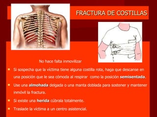 FRACTURA DE COSTILLAS No hace falta inmovilizar Si sospecha que la víctima tiene alguna costilla rota, haga que descanse en una posición que le sea cómoda al respirar  como la posición  semisentada .  Use una  almohada  delgada o una manta doblada para sostener y mantener inmóvil la fractura.  Si existe una  herida  cúbrala totalmente.  Traslade la víctima a un centro asistencial.  