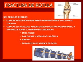 FRACTURA DE ROTULA SIN FERULAS RÍGIDAS COLOCAR ACOLCHADO ENTRE AMBOS MIEMBROS DESDE INGLE HASTA TOBILLOS. COLOCAR LOS VENDAJES, APROVECHANDO LOS ESPACIOS NATURALES, Y ANUDARLOS SOBRE EL MIEMBRO NO LESIONADO : EN EL MUSLO POR ENCIMA Y DEBAJO DE LA RÓTULA PIERNAS EN LOS PIES CON VENDAJE EN OCHO . 