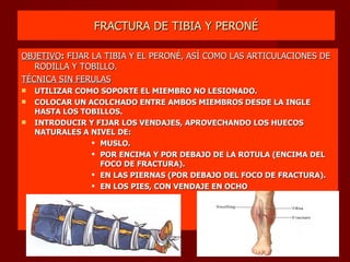 FRACTURA DE TIBIA Y PERONÉ OBJETIVO :  FIJAR LA TIBIA Y EL PERONÉ, ASÍ COMO LAS ARTICULACIONES DE RODILLA Y TOBILLO. TÉCNICA SIN FERULAS UTILIZAR COMO SOPORTE EL MIEMBRO NO LESIONADO. COLOCAR UN ACOLCHADO ENTRE AMBOS MIEMBROS DESDE LA INGLE HASTA LOS TOBILLOS. INTRODUCIR Y FIJAR LOS VENDAJES, APROVECHANDO LOS HUECOS NATURALES A NIVEL DE: MUSLO. POR ENCIMA Y POR DEBAJO DE LA ROTULA (ENCIMA DEL FOCO DE FRACTURA). EN LAS PIERNAS (POR DEBAJO DEL FOCO DE FRACTURA). EN LOS PIES, CON VENDAJE EN OCHO 