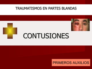 TRAUMATISMOS EN PARTES BLANDAS CONTUSIONES PRIMEROS AUXILIOS 