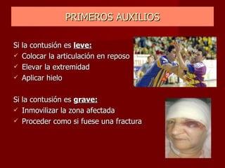 PRIMEROS AUXILIOS Si la contusión es  leve: Colocar la articulación en reposo Elevar la extremidad Aplicar hielo Si la contusión es  grave: Inmovilizar la zona afectada Proceder como si fuese una fractura 