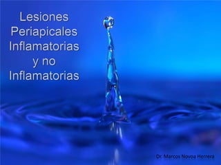Lesiones Periapicales Inflamatorias y no Inflamatorias Dr. Marcos Novoa Herrera 
